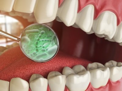 A close-up view of a mouth with teeth and gums. A magnifying glass highlights part of the tongue, revealing green bacteria or microorganisms.