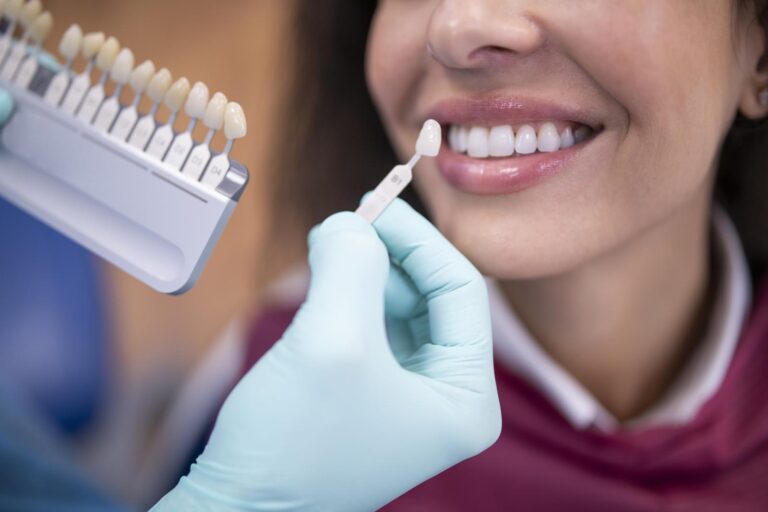 The image shows a dental professional wearing gloves holding a shade guide next to a patient's mouth. The shade guide contains various shades of artificial teeth, which are used to match the color of dental restorations to the patient's natural teeth.